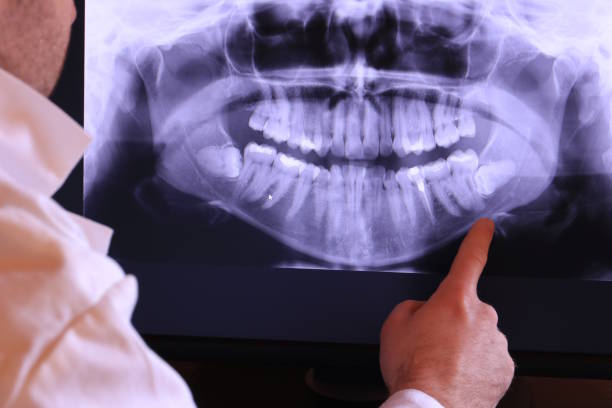 Best Emergency Dental Extractions in Lindale, TX